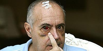 Detienen en Albania al agresor de José Luis Moreno Detienen en Albania al agresor de José Luis Moreno