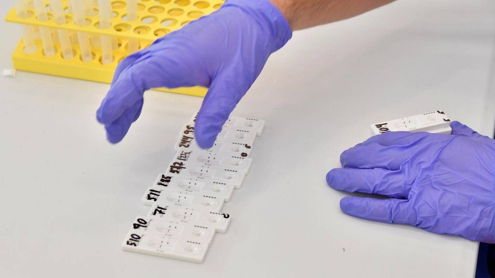 La Comunidad de Madrid realizará test de antígenos en Boadilla del Monte La Comunidad de Madrid realizará test de antígenos en Boadilla del Monte